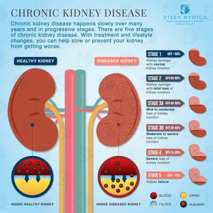 Chronic renal failure hesi case study