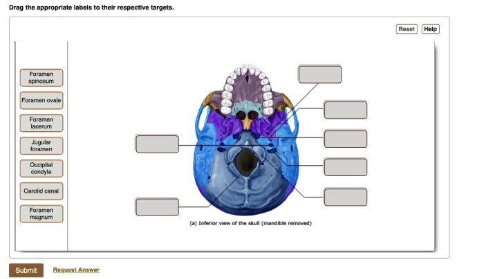 Drag the appropriate labels to their respective targets. skull